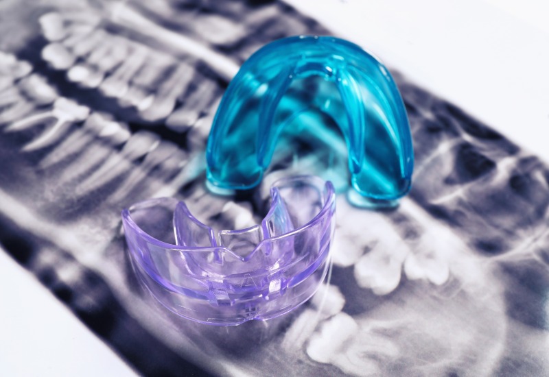 Colored mouthguards on a dental X-ray, emphasizing sports safety in Germantown, TN