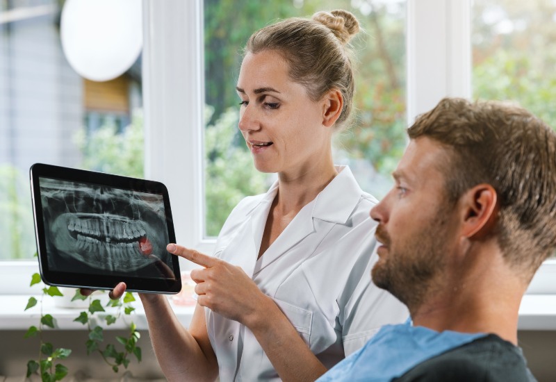 A dentist explaining X-ray, highlighting reasons for wisdom teeth removal in Germantown, TN