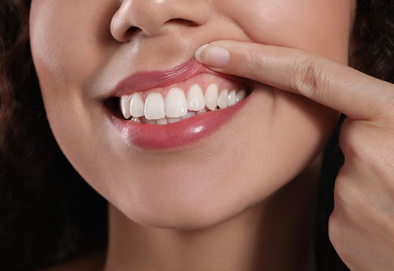 Woman showing healthy gums and a bright smile, promoting gum care exam in Germantown, TN